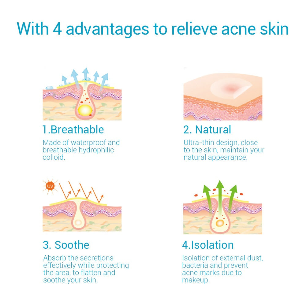 Acne Patch - Laat Acne Verdwijnen