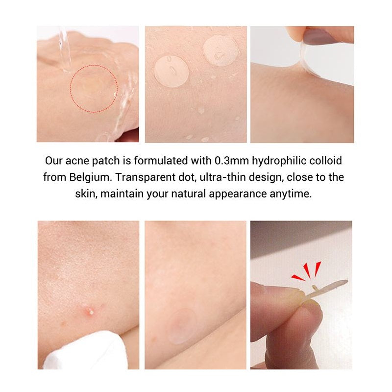 Acne Patch - Laat Acne Verdwijnen