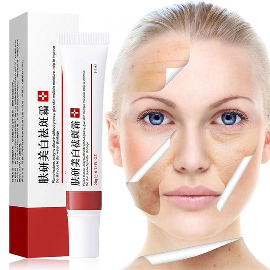 Verzorgende Anti-Vlekken Crème